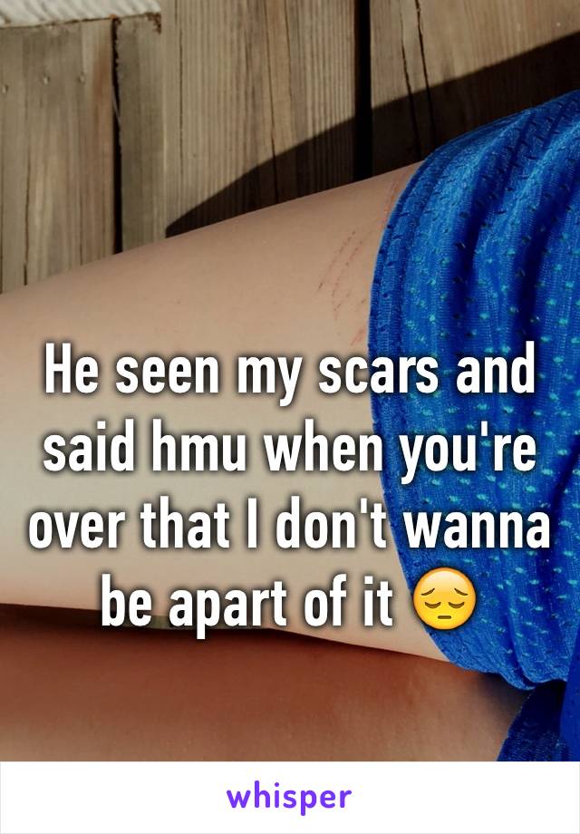 He seen my scars and said hmu when you're over that I don't wanna be apart of it 😔