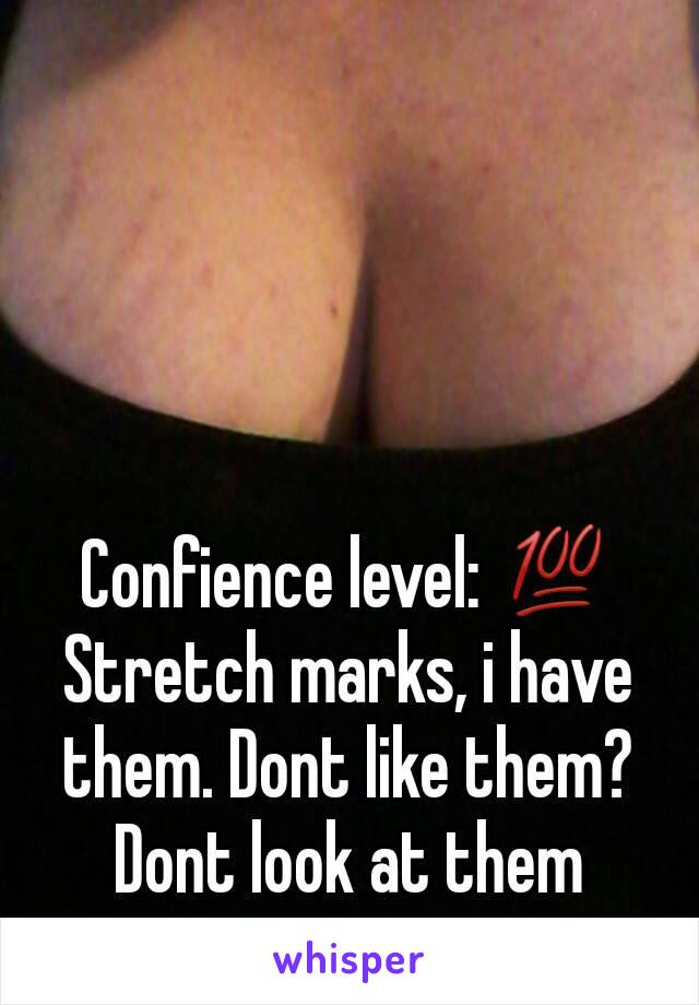 Confience level: 💯
Stretch marks, i have them. Dont like them? Dont look at them