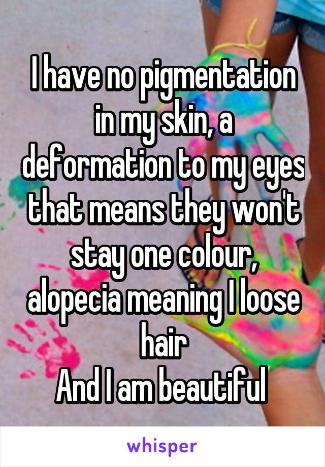 I have no pigmentation in my skin, a deformation to my eyes that means they won't stay one colour, alopecia meaning I loose hair
And I am beautiful 