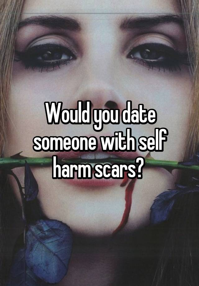 would you date someone with acne scars