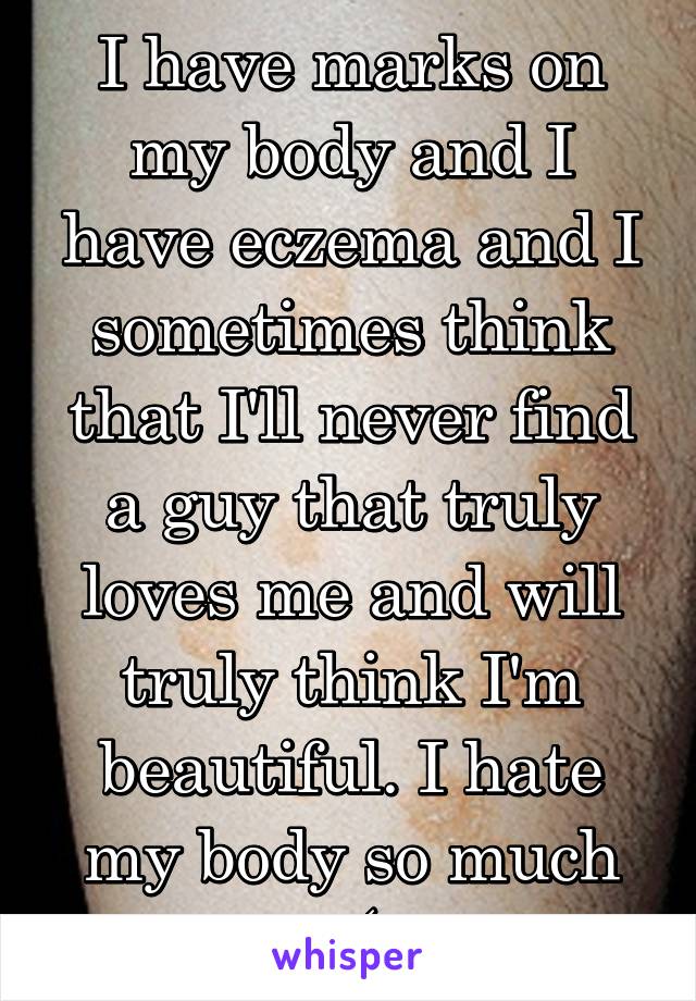 I have marks on my body and I have eczema and I sometimes think that I'll never find a guy that truly loves me and will truly think I'm beautiful. I hate my body so much :-( 