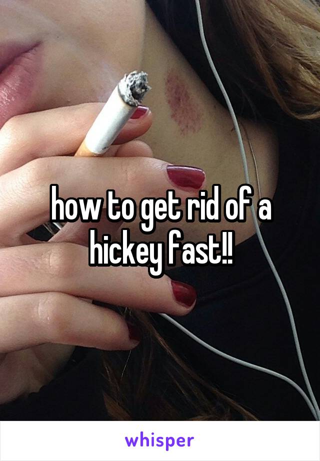 how to get rid of a hickey fast!!