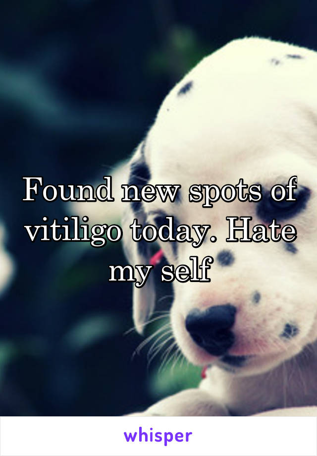 Found new spots of vitiligo today. Hate my self