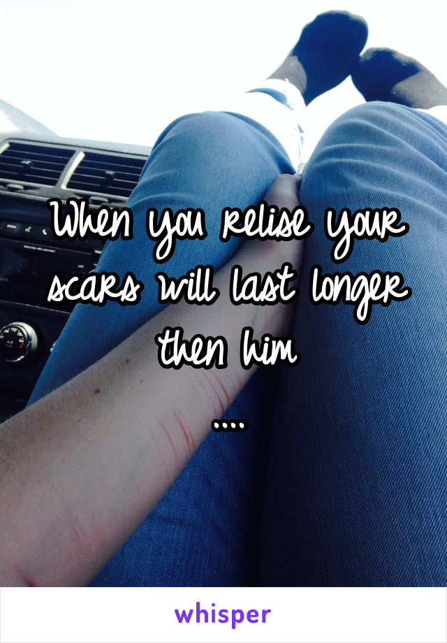 When you relise your scars will last longer then him
....