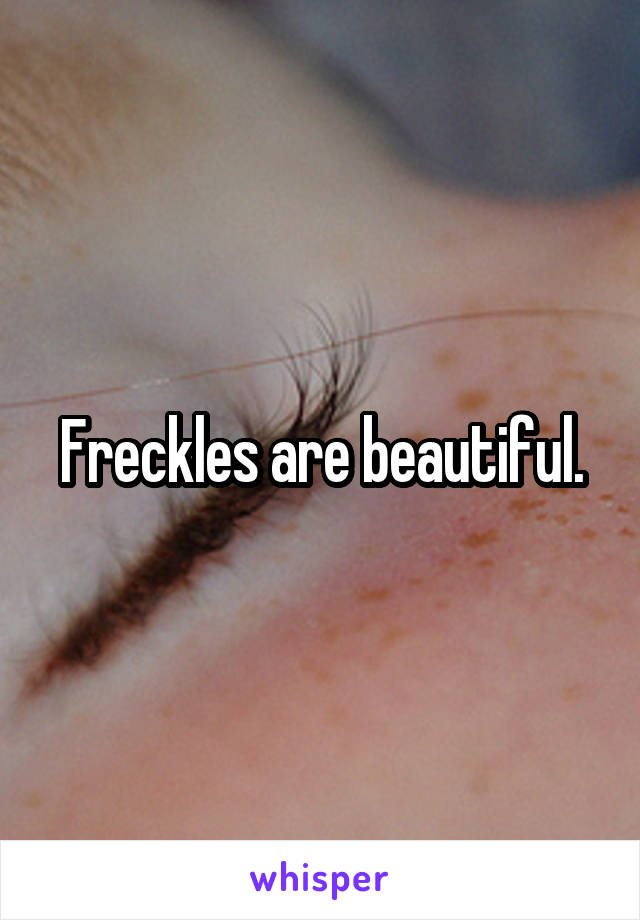 Freckles are beautiful.