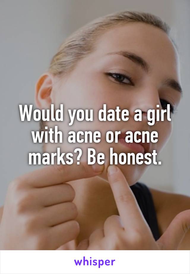 Would you date a girl with acne or acne marks? Be honest.