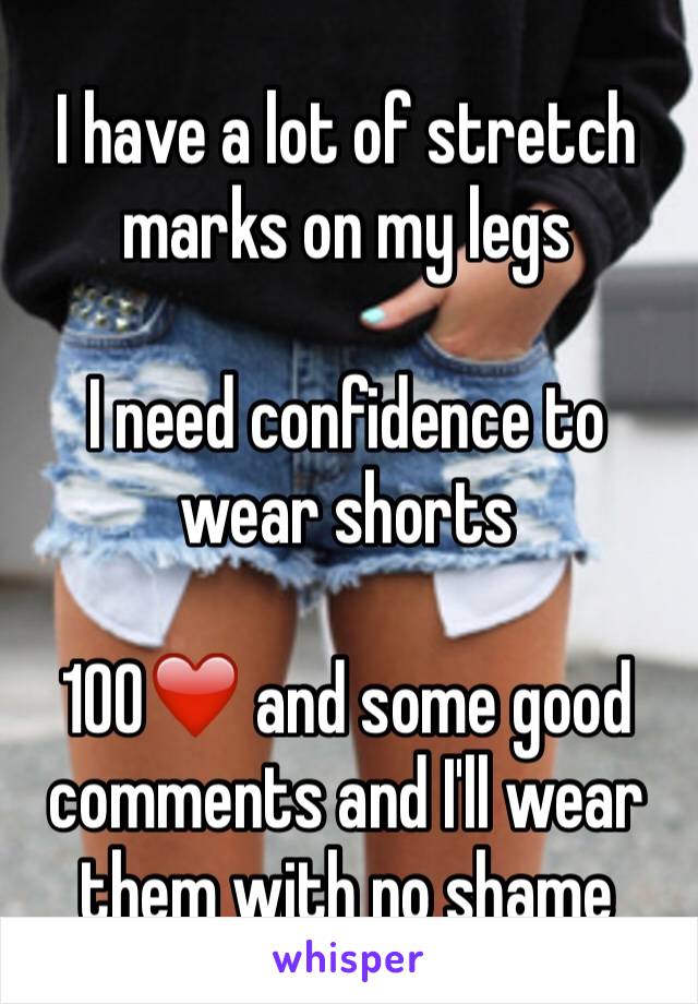 I have a lot of stretch marks on my legs

I need confidence to wear shorts

100❤️ and some good comments and I'll wear them with no shame