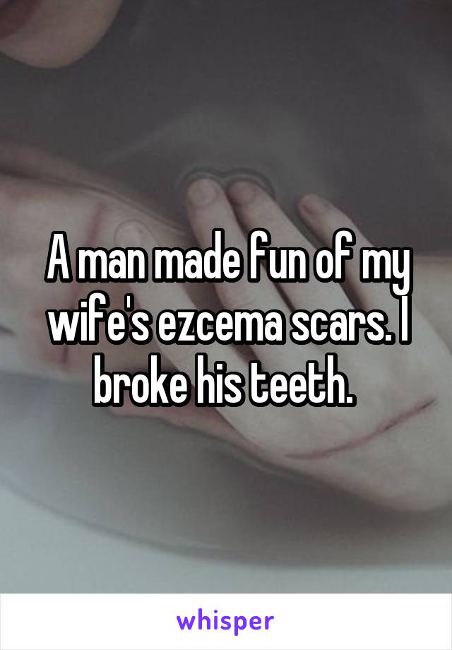 A man made fun of my wife's ezcema scars. I broke his teeth. 