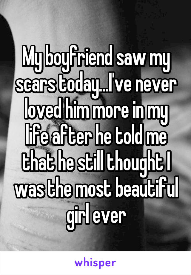 My boyfriend saw my scars today...I've never loved him more in my life after he told me that he still thought I was the most beautiful girl ever