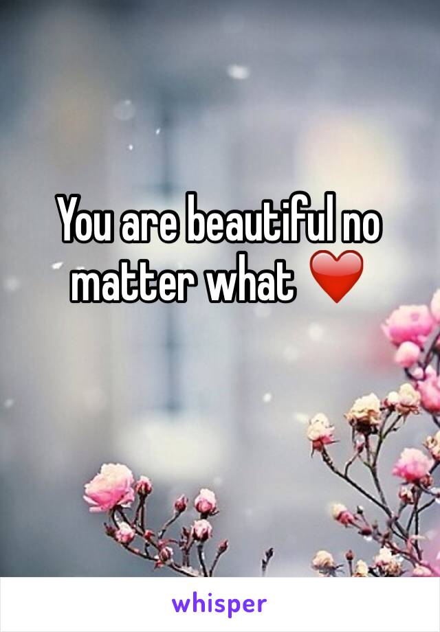 You are beautiful no matter what ❤️