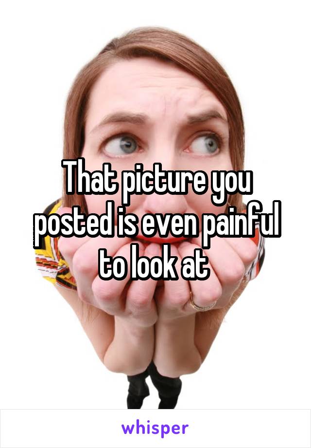 That picture you posted is even painful to look at 