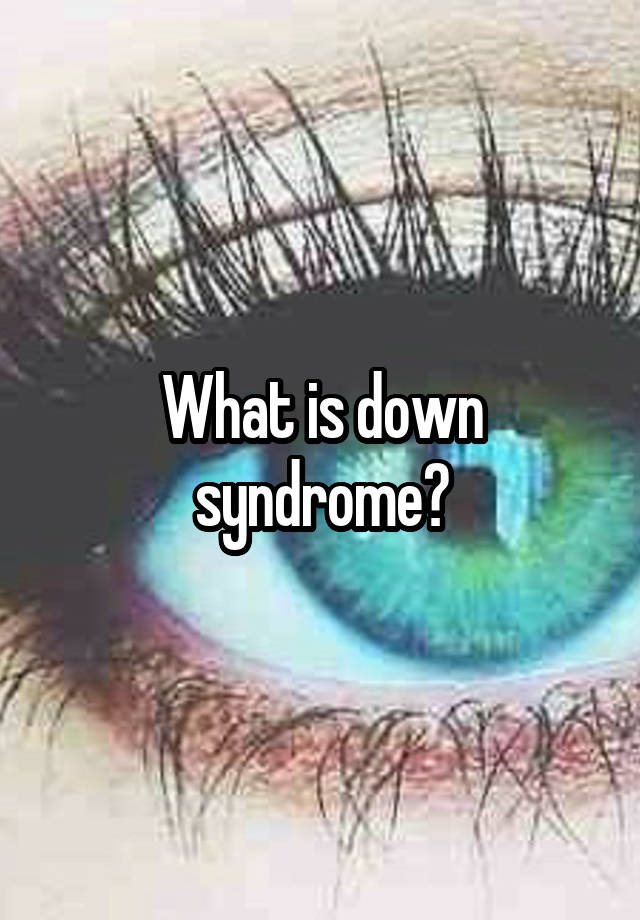 what-is-down-syndrome