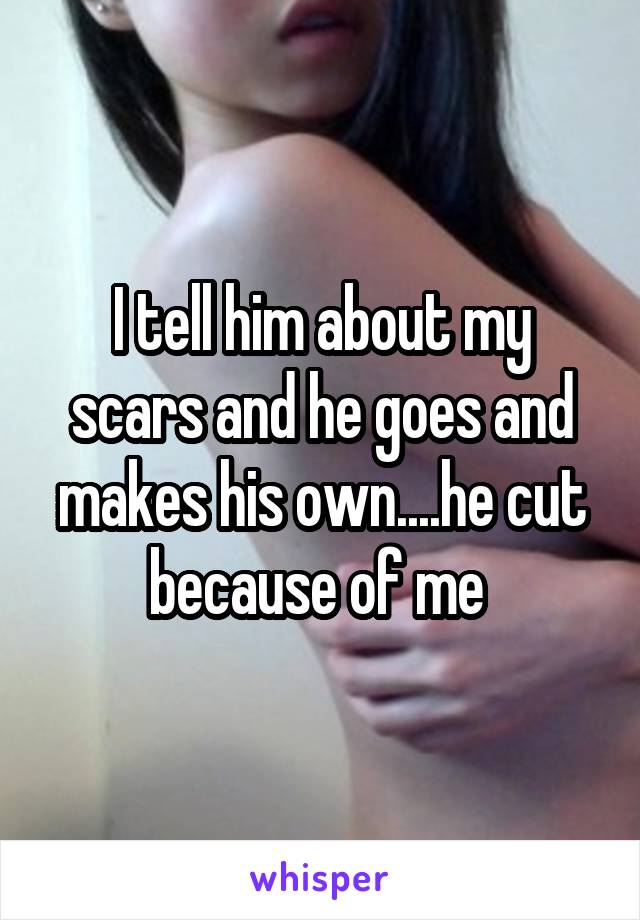 I tell him about my scars and he goes and makes his own....he cut because of me 
