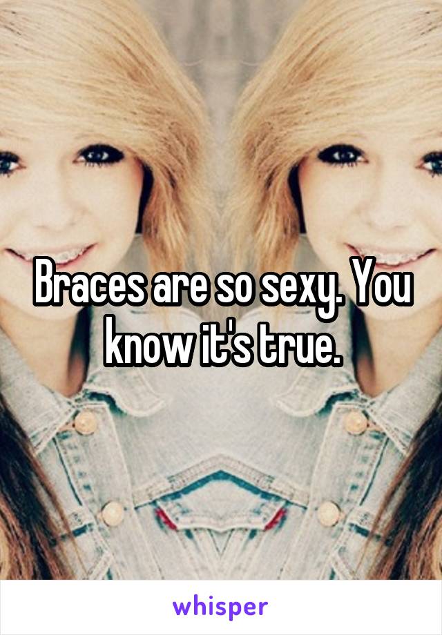 Braces are so sexy. You know it's true.