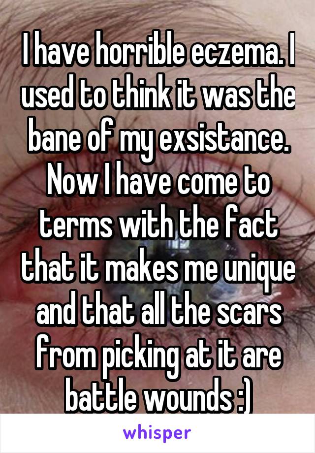 I have horrible eczema. I used to think it was the bane of my exsistance. Now I have come to terms with the fact that it makes me unique and that all the scars from picking at it are battle wounds :)