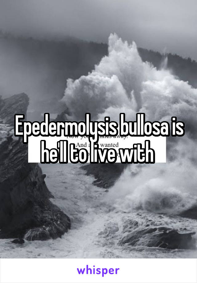 Epedermolysis bullosa is he'll to live with 