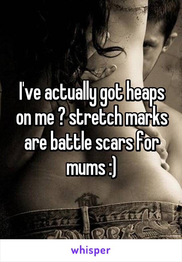 I've actually got heaps on me 😂 stretch marks are battle scars for mums :)