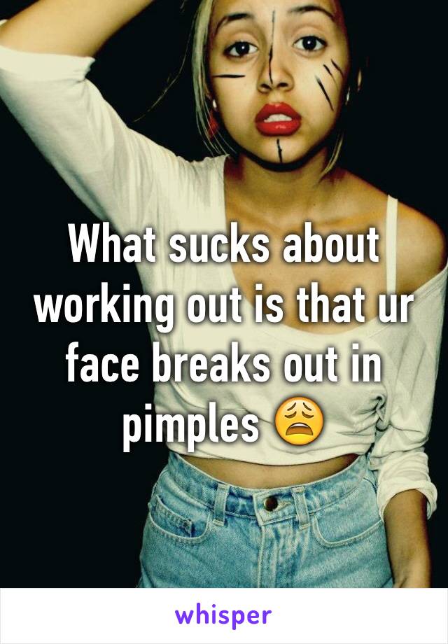 What sucks about working out is that ur face breaks out in pimples 😩