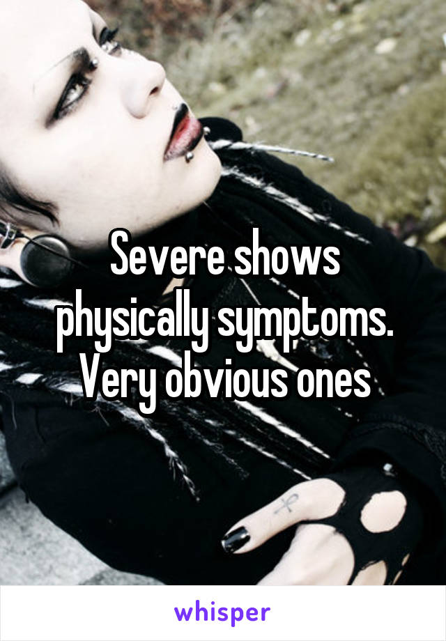 Severe shows physically symptoms. Very obvious ones