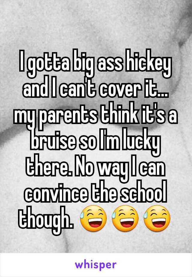 I gotta big ass hickey and I can't cover it... my parents think it's a bruise so I'm lucky there. No way I can convince the school though. 😅😅😅