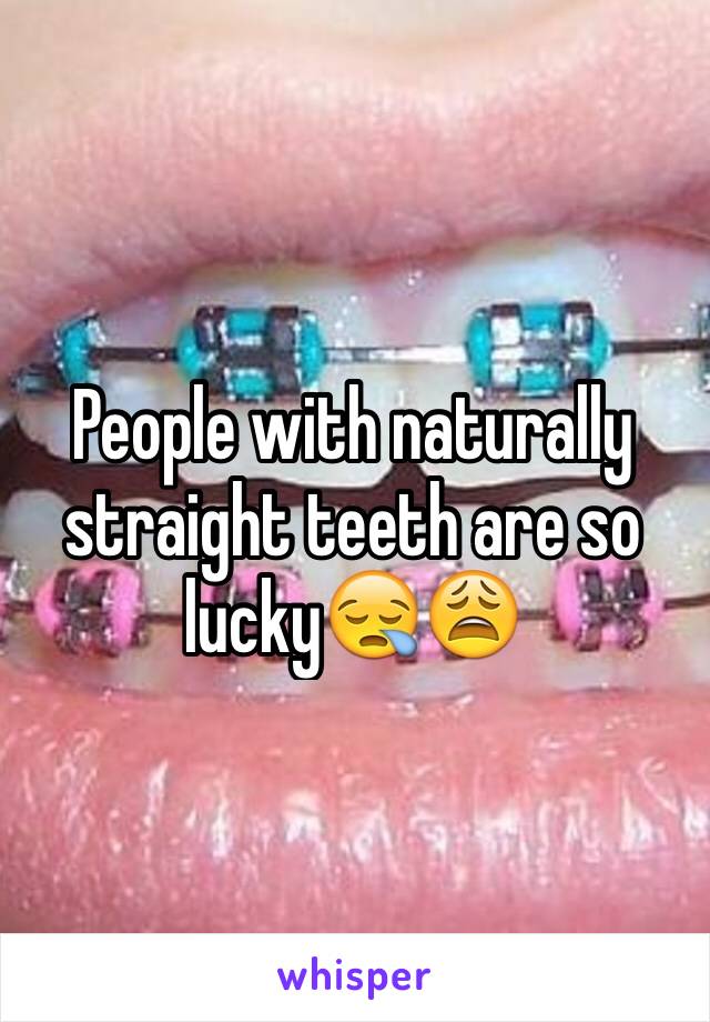 People with naturally straight teeth are so lucky😪😩