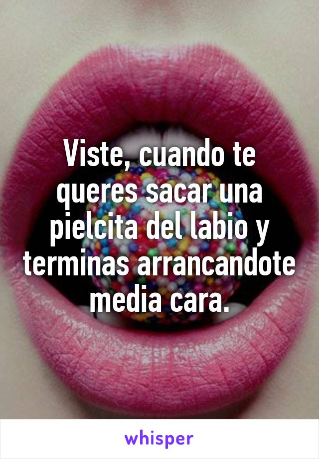 Viste, cuando te queres sacar una pielcita del labio y terminas arrancandote media cara.