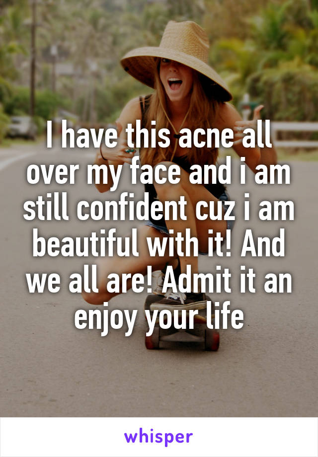 I have this acne all over my face and i am still confident cuz i am beautiful with it! And we all are! Admit it an enjoy your life