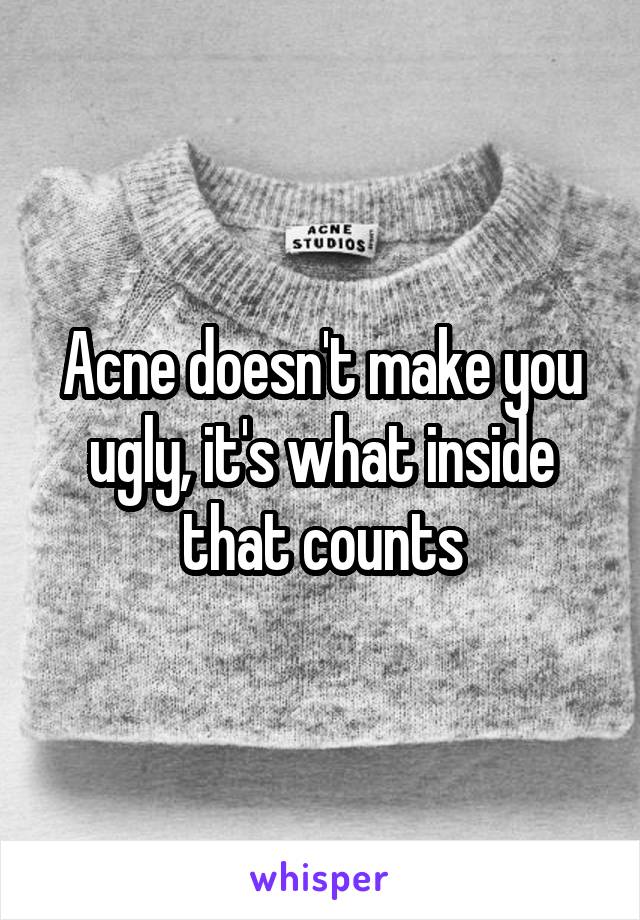 Acne doesn't make you ugly, it's what inside that counts