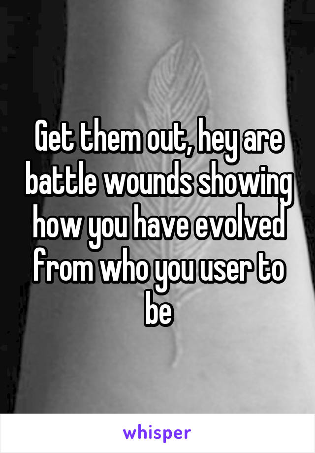 Get them out, hey are battle wounds showing how you have evolved from who you user to be