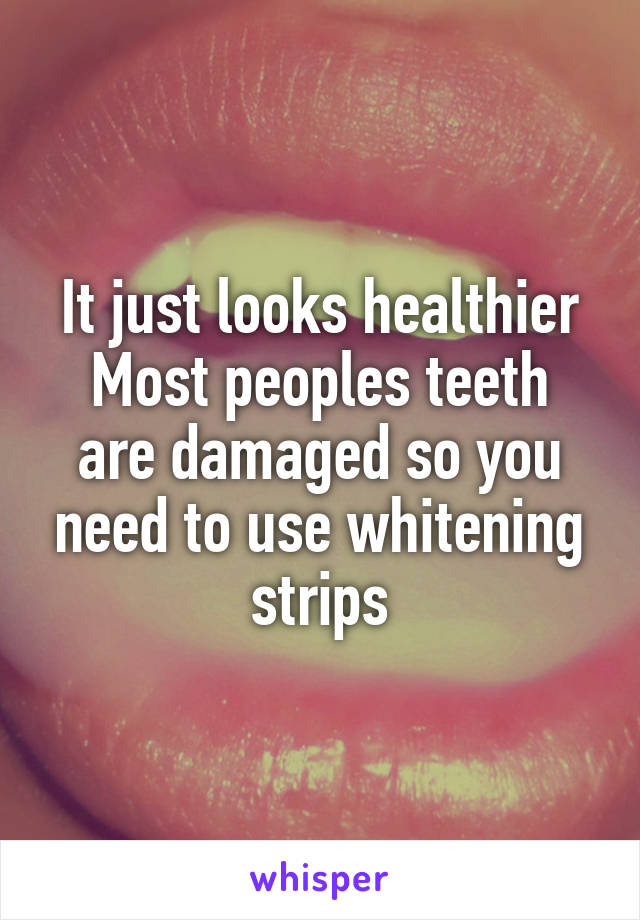 It just looks healthier
Most peoples teeth are damaged so you need to use whitening strips
