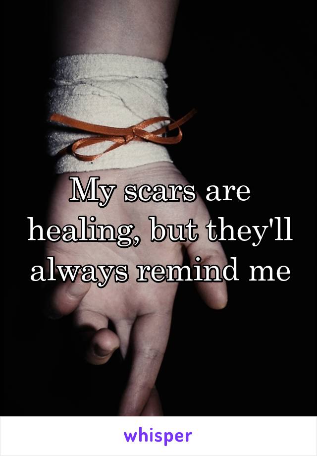 My scars are healing, but they'll always remind me