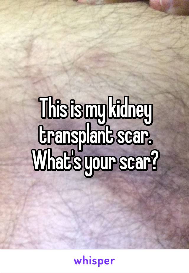 This is my kidney transplant scar. What's your scar?