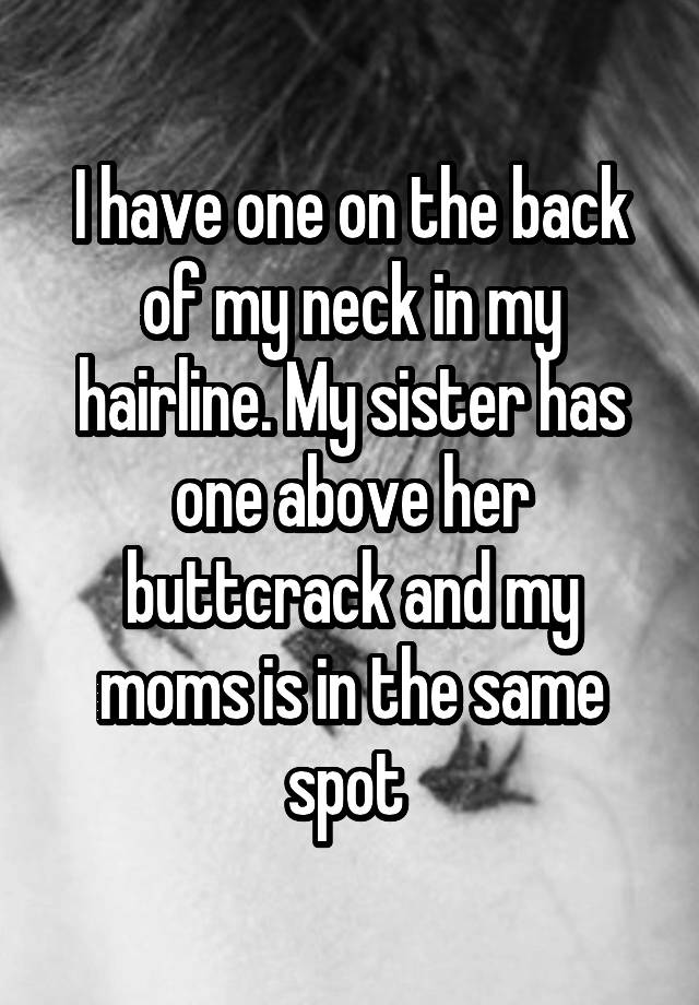 i-have-one-on-the-back-of-my-neck-in-my-hairline-my-sister-has-one