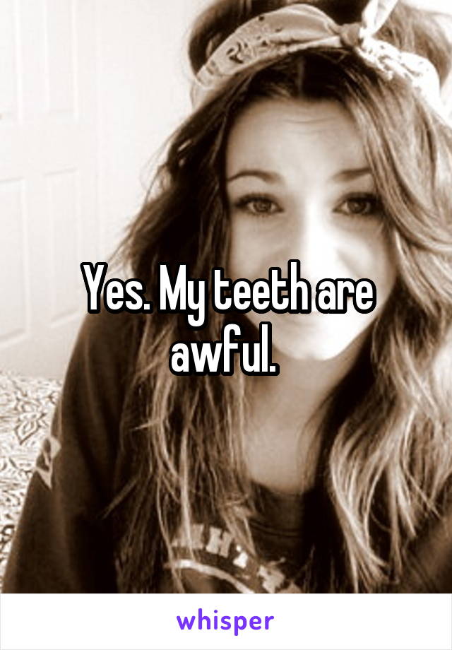 Yes. My teeth are awful. 