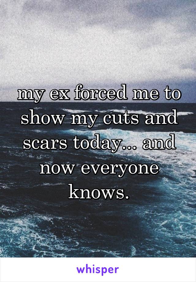 my ex forced me to show my cuts and scars today... and now everyone knows.