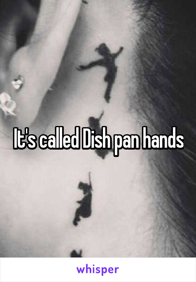 It's called Dish pan hands