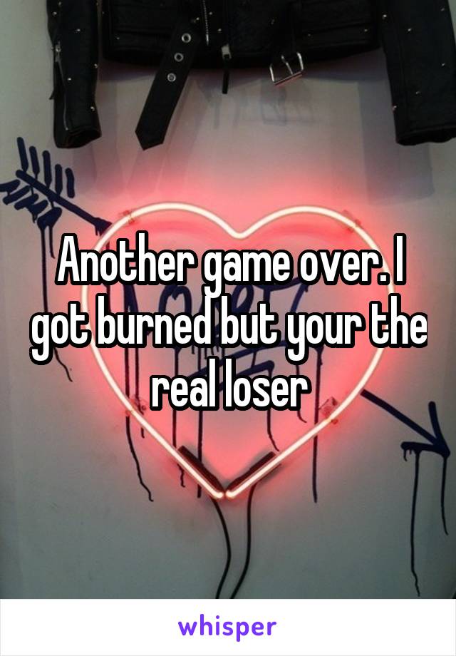 Another game over. I got burned but your the real loser