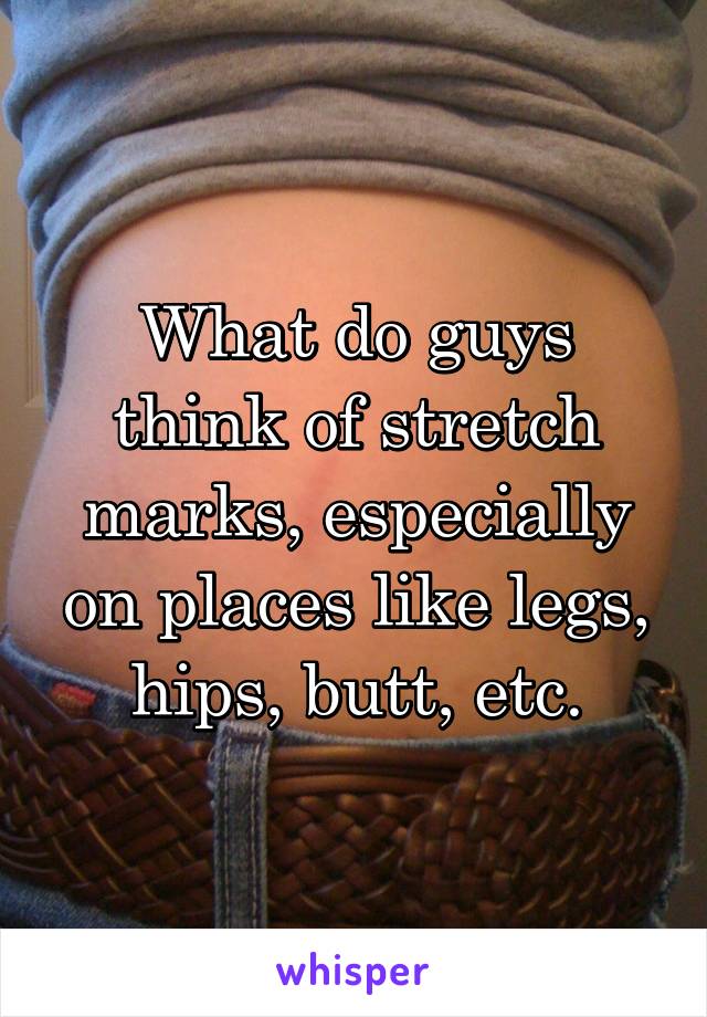 What do guys think of stretch marks, especially on places like legs, hips, butt, etc.