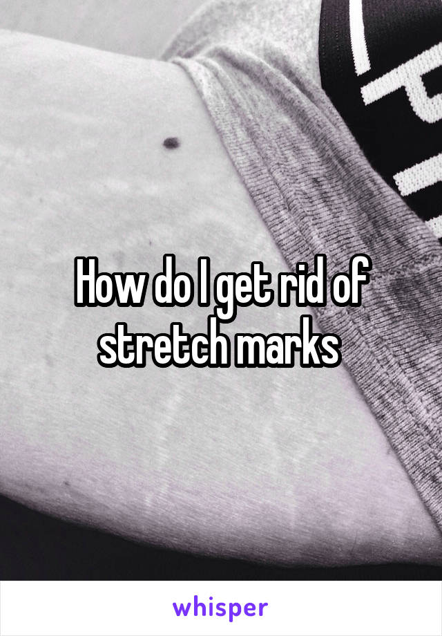 How do I get rid of stretch marks 