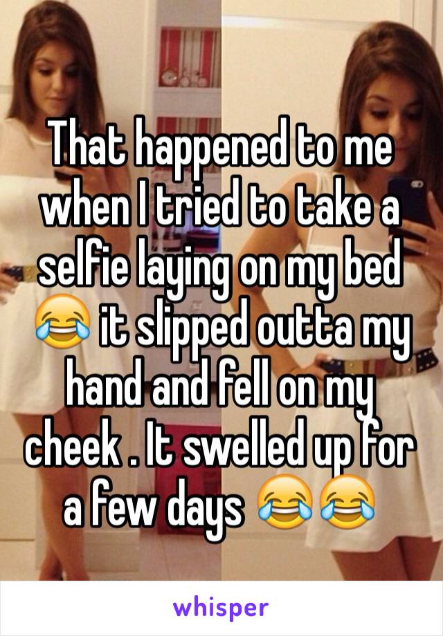 That happened to me when I tried to take a selfie laying on my bed 😂 it slipped outta my hand and fell on my cheek . It swelled up for a few days 😂😂