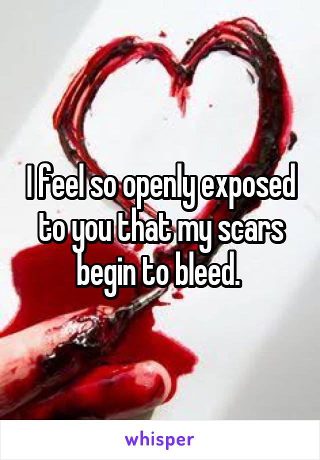 I feel so openly exposed to you that my scars begin to bleed. 