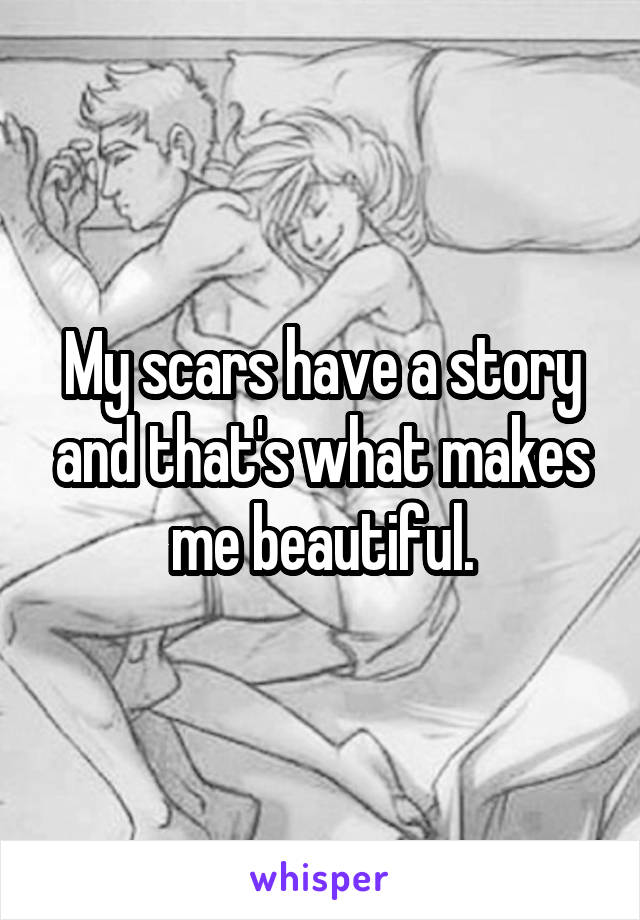 My scars have a story and that's what makes me beautiful.