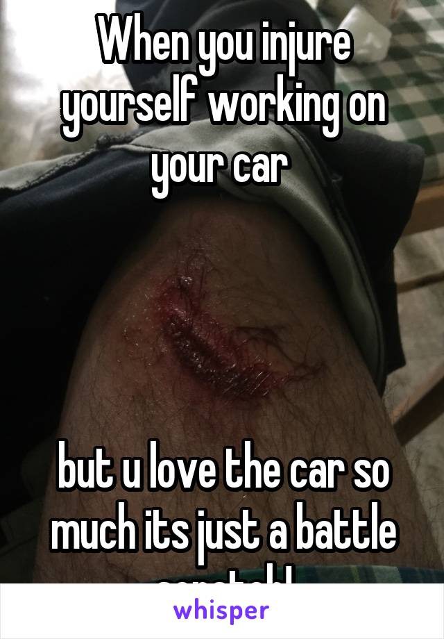 When you injure yourself working on your car 




but u love the car so much its just a battle scratch!