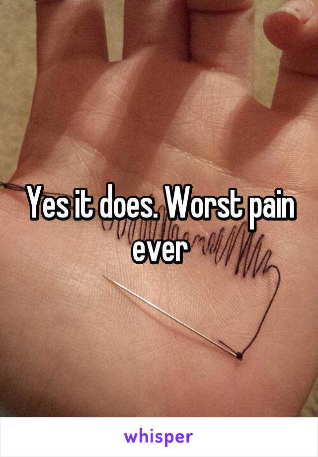 Yes it does. Worst pain ever