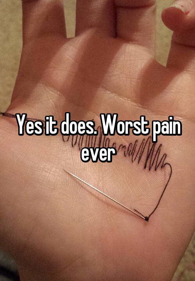 yes-it-does-worst-pain-ever