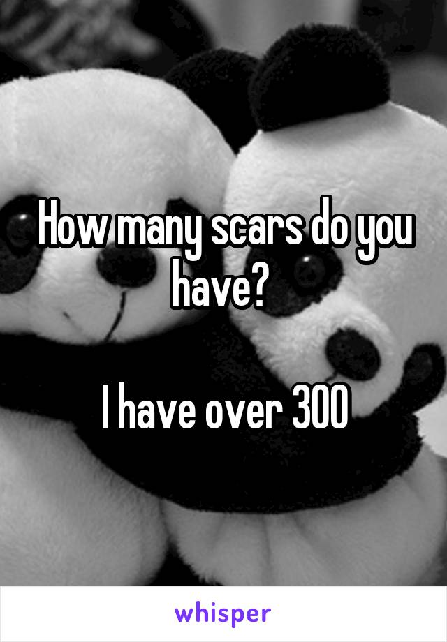 How many scars do you have? 

I have over 300