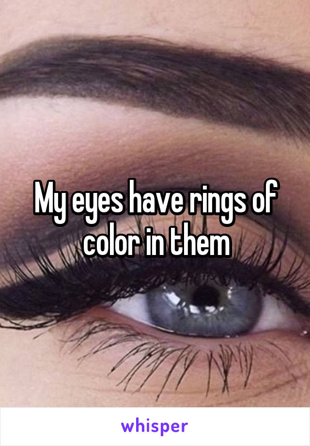 My eyes have rings of color in them