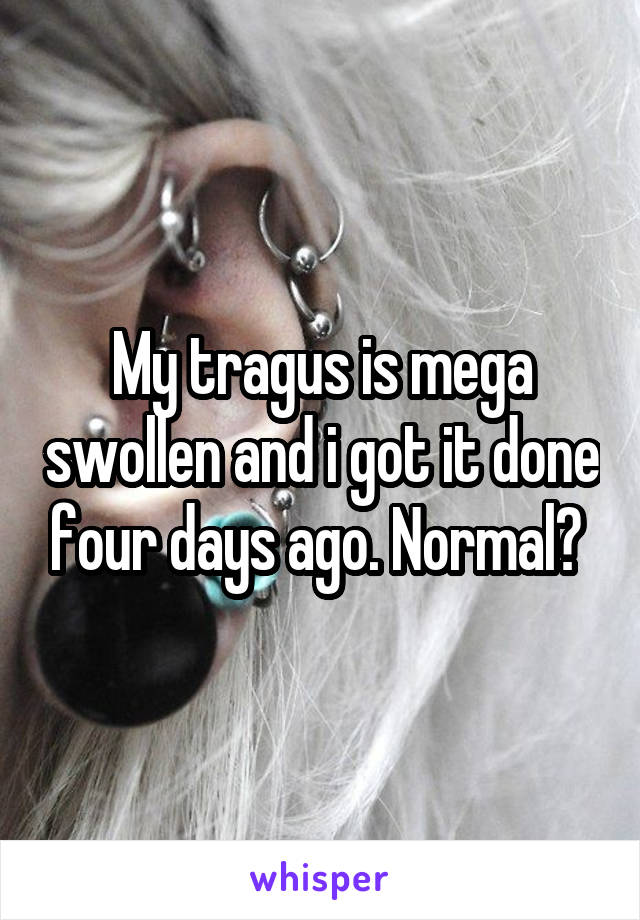 My tragus is mega swollen and i got it done four days ago. Normal? 
