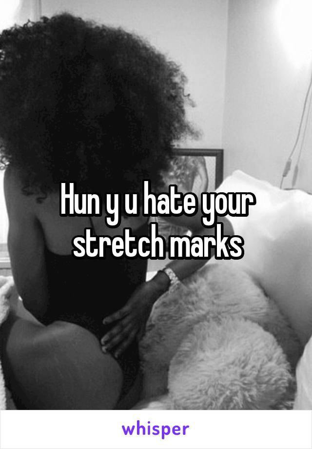 Hun y u hate your stretch marks