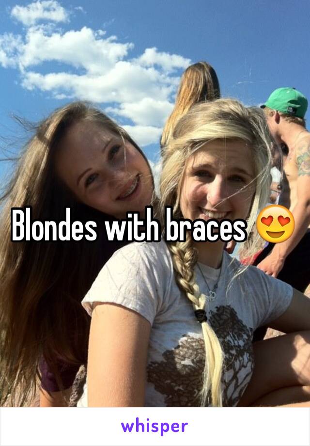 Blondes with braces 😍